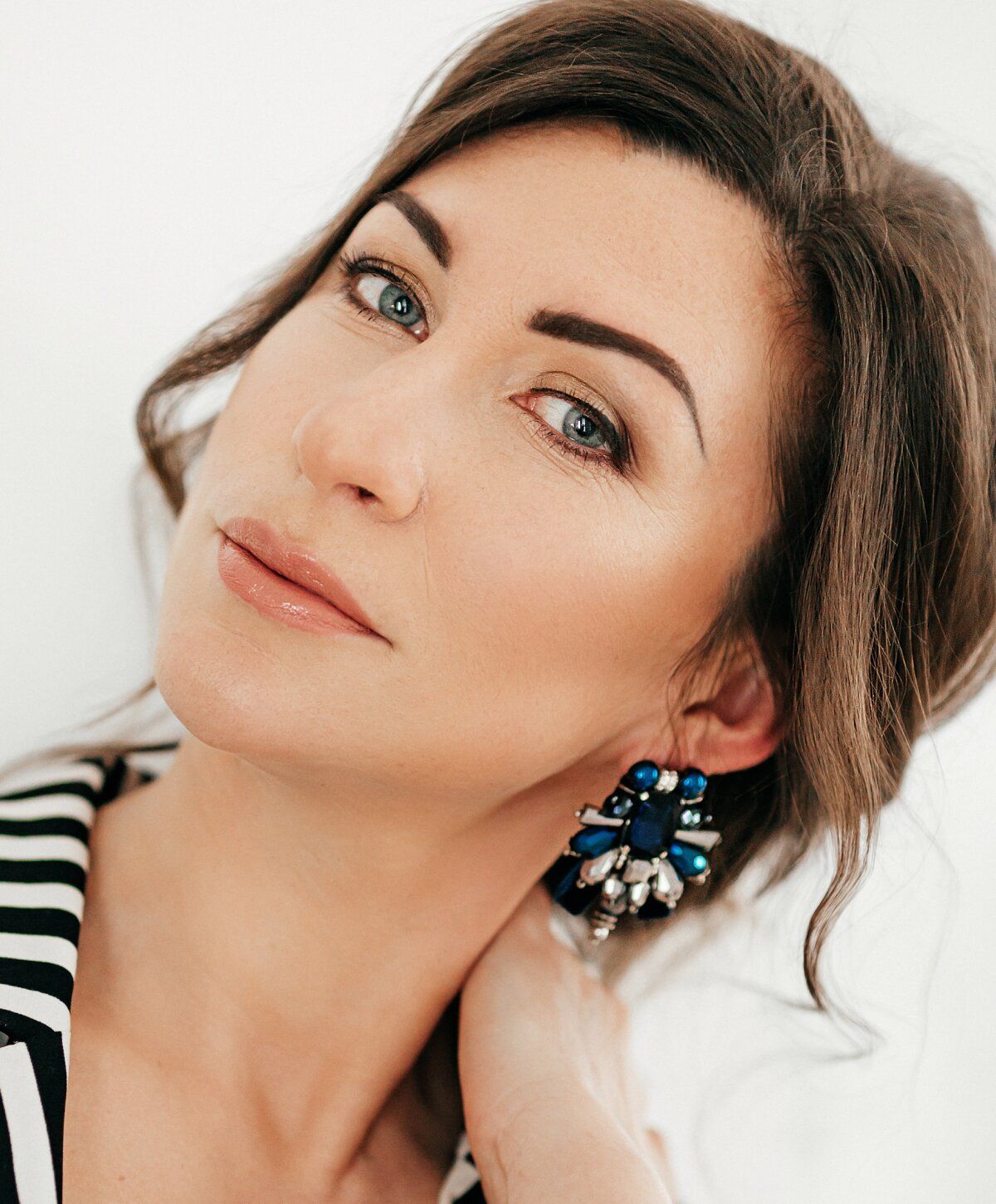Memphis BBL Laser Treatments model with blue eyes