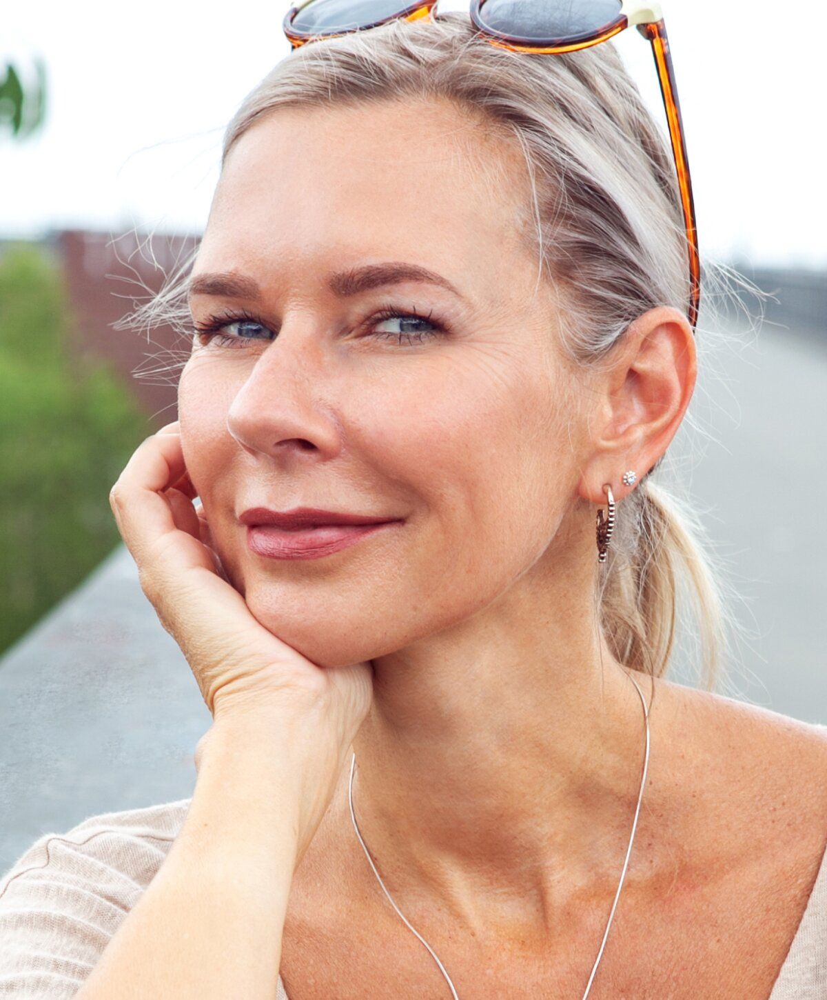 Memphis BBL Laser Treatment model with blue eyes