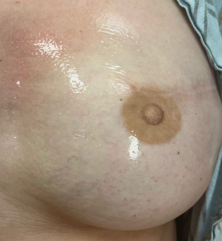 Nipple Tattooing Before & After