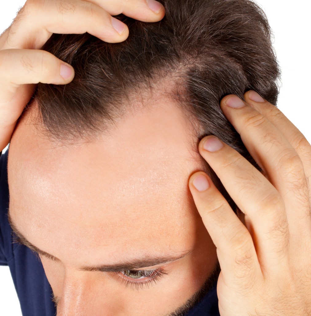 Hair Restoration for Men with NeoGraft | Plastic Surgery Group Memphis