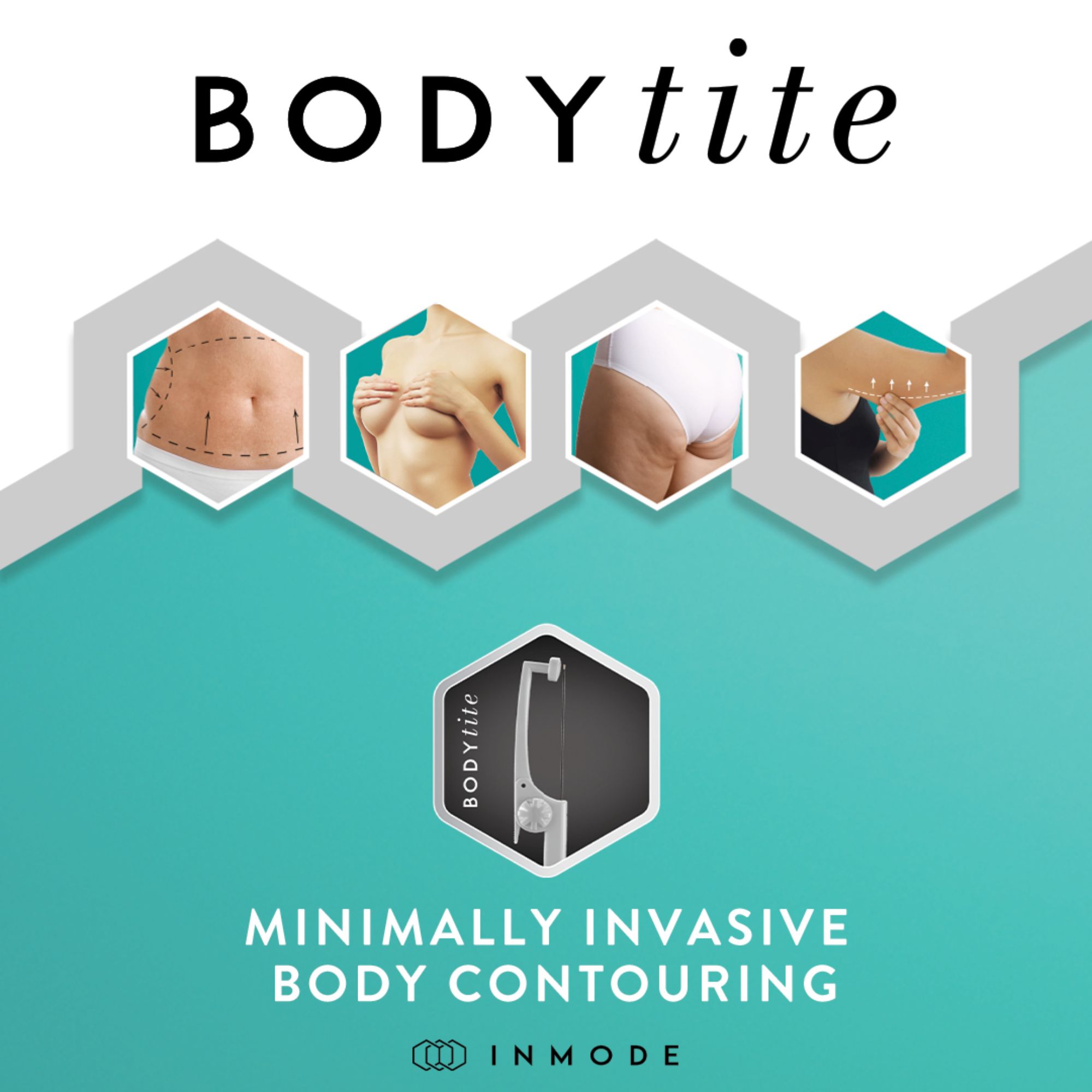 bodytite-treatment-area-instagram-post-preview-4