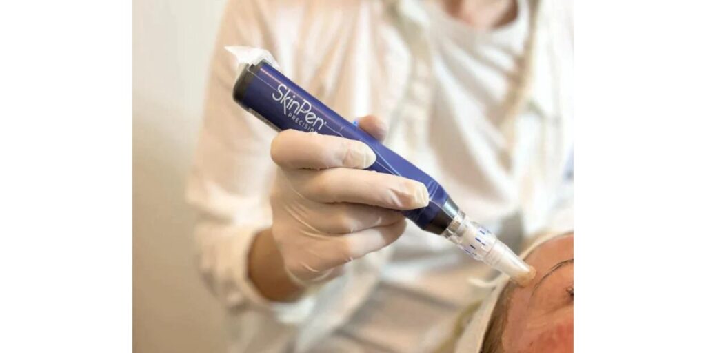 Revitalize Your Skin with SkinPen Microneedling 